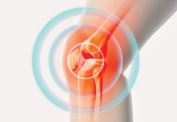 Terapia con células madre: una alternativa para la osteoartritis de rodilla